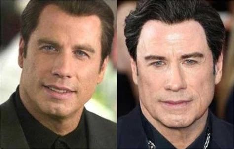 john travolta face lift|John Travoltas Plastic Surgery (Botox and Facelift)